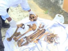 Malabo: Detenido un médico forense por transporte indebido de restos humanos en su vehículo