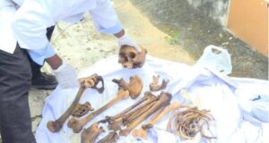 Malabo: Detenido un médico forense por transporte indebido de restos humanos en su vehículo