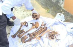 Malabo: Detenido un médico forense por transporte indebido de restos humanos en su vehículo