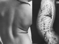 Malabo: Una madre clama ayuda para tratar la grave enfermedad de su hijo de tres años