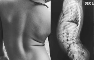 Malabo: Una madre clama ayuda para tratar la grave enfermedad de su hijo de tres años