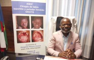 El doctor Santiago Angüe Masoko, cirujano del Hospital INSESO: “Queremos llegar a todos los niños del país con labio leporino”