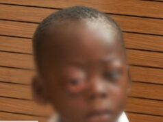 SOLIDARIDAD URGENTE PARA SALVAR LA VISIÓN DE UN NIÑO EN BATA