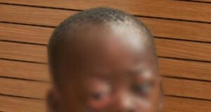 SOLIDARIDAD URGENTE PARA SALVAR LA VISIÓN DE UN NIÑO EN BATA