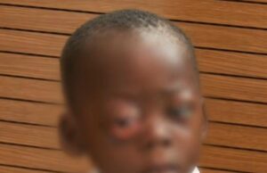 SOLIDARIDAD URGENTE PARA SALVAR LA VISIÓN DE UN NIÑO EN BATA