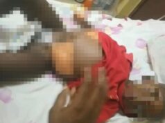 Un niño lucha contra el cáncer en Bata y su familia pide ayuda urgente
