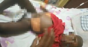 Un niño lucha contra el cáncer en Bata y su familia pide ayuda urgente