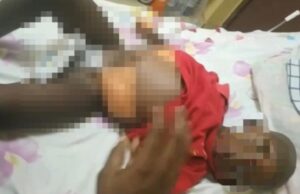 Un niño lucha contra el cáncer en Bata y su familia pide ayuda urgente