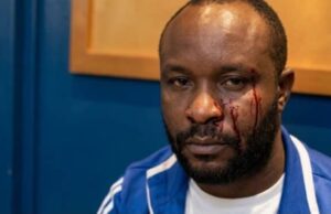 Un ciudadano camerunés denuncia una presunta agresión por parte de agentes de tráfico en Semu